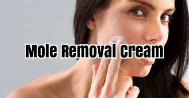 Best Mole Removal Cream, Mole Removal Cream Reviews
