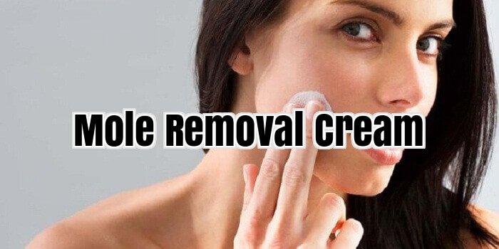 10 Best Mole Removal Cream Which Works Magically