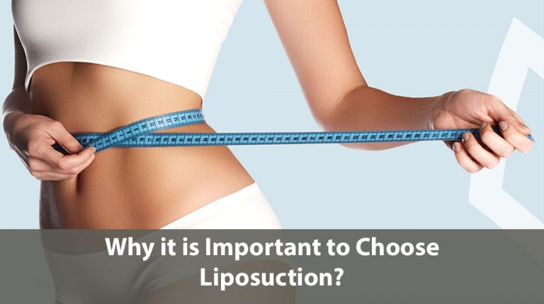 Why it is Important to Choose Liposuction?
