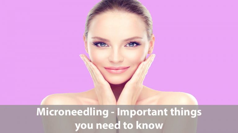 Microneedling – Important things you need to know