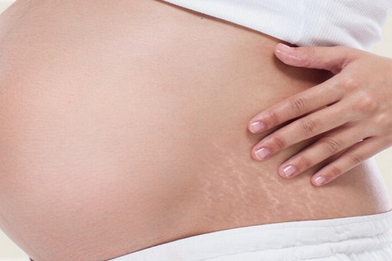 Best Pregnancy Belly Cream for Stretchmarks